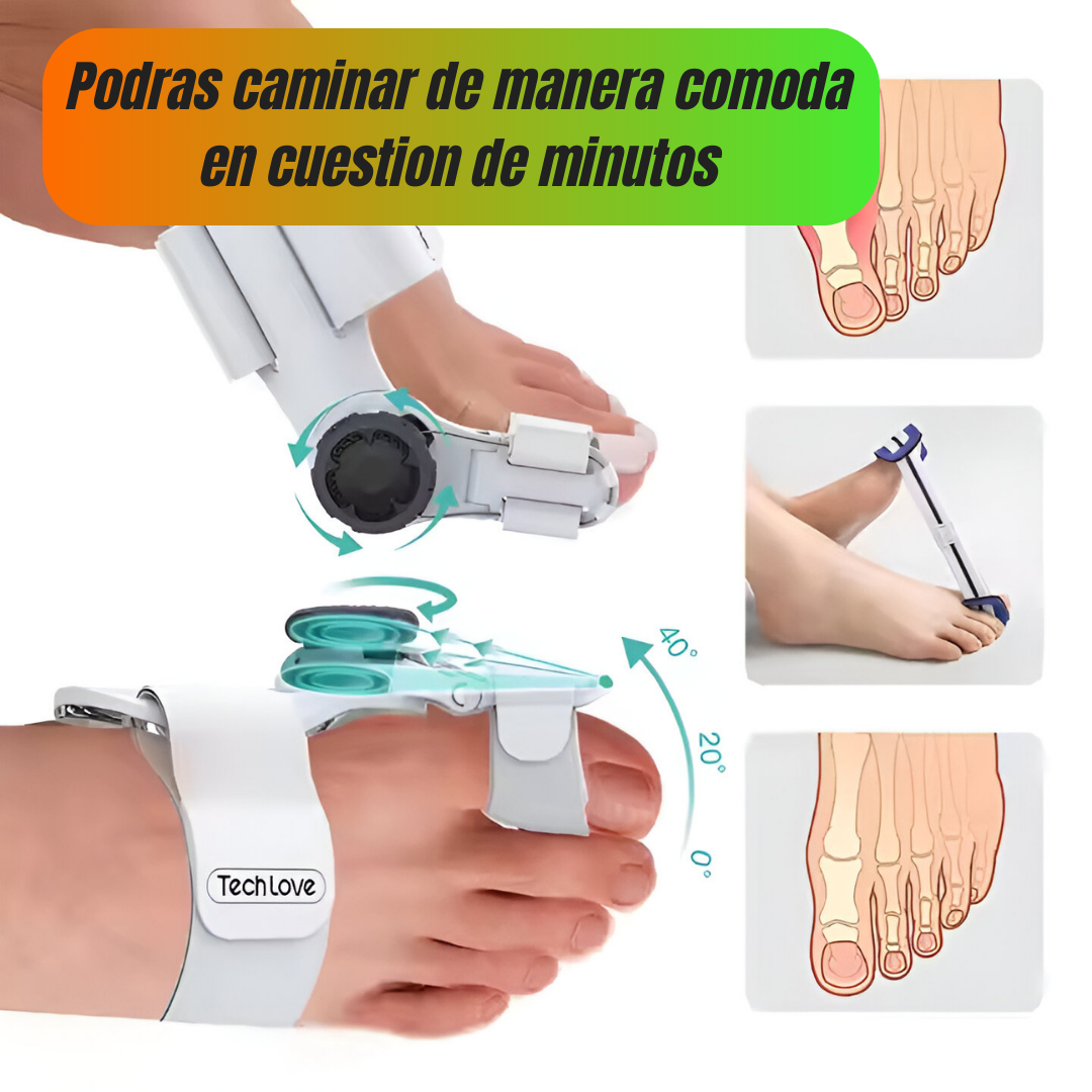 ✨ ¡Lleva tu Corrector Ortopédico para Juanetes por solo Q199 y recibe REGALOS EXCLUSIVOS + ENVÍO GRATIS! ✨